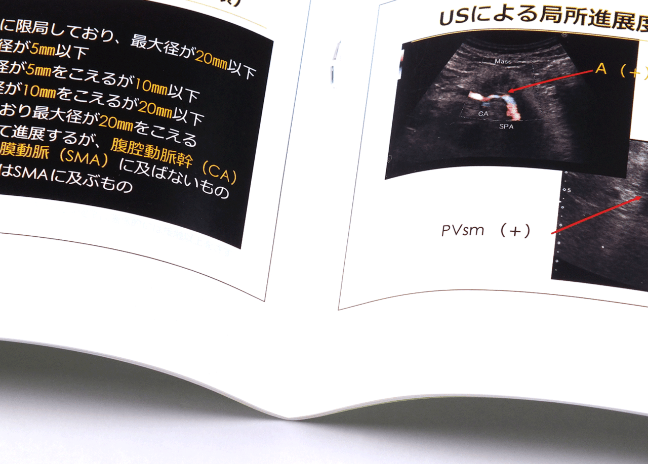 オンデマンド印刷と中綴じ製本で作成した小冊子（セミナー用のテキスト）に使用された針金を拡大した画像です。